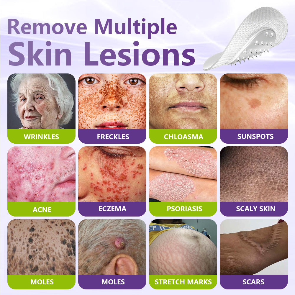 Miretha™ Soluble Microneedle Botanical Skin Tag Removal Patch
